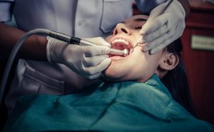 Debunking Common Myths About Root Canals in Langdon