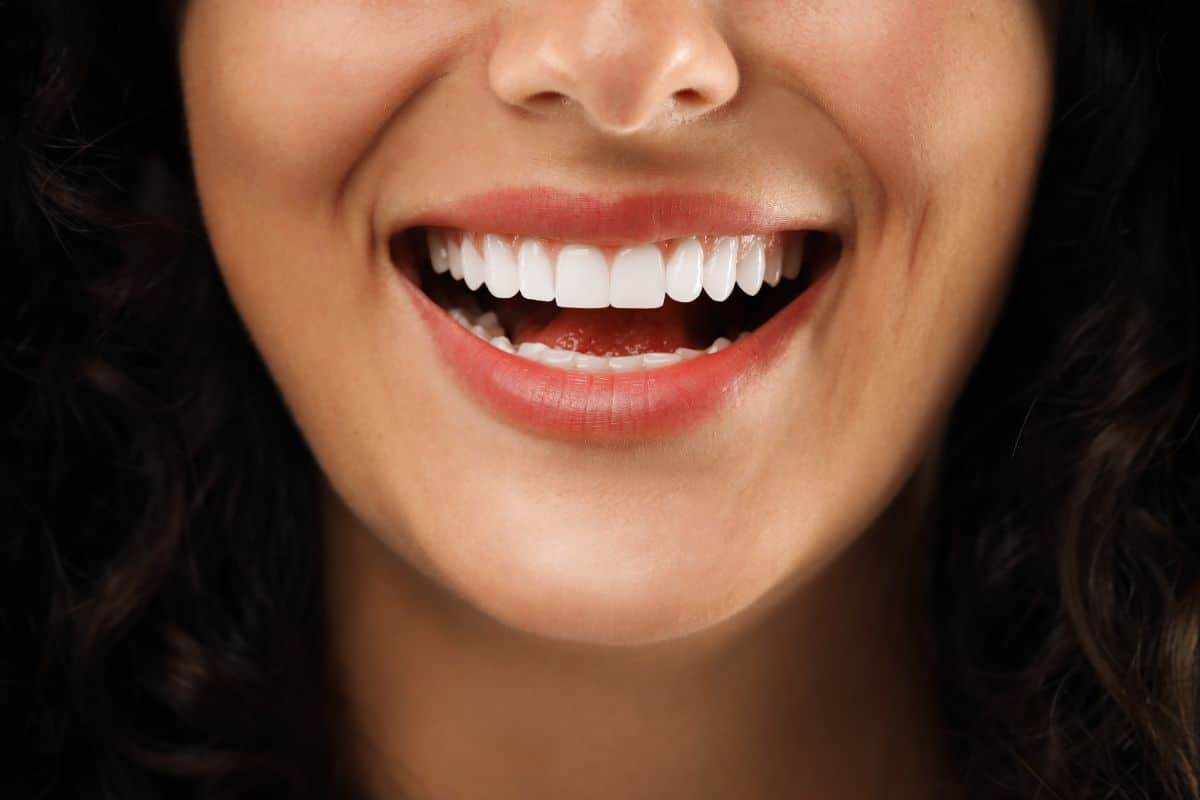 Teeth Cleaning Remove Yellow Stains