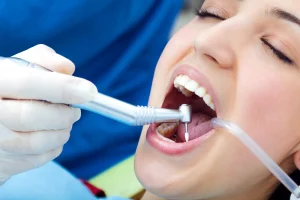 dental fillings pain expectations